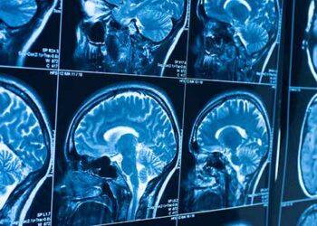 Beyin xərçənginin müalicəsi üçün yeni müalicə üsulu kəşf edildi!